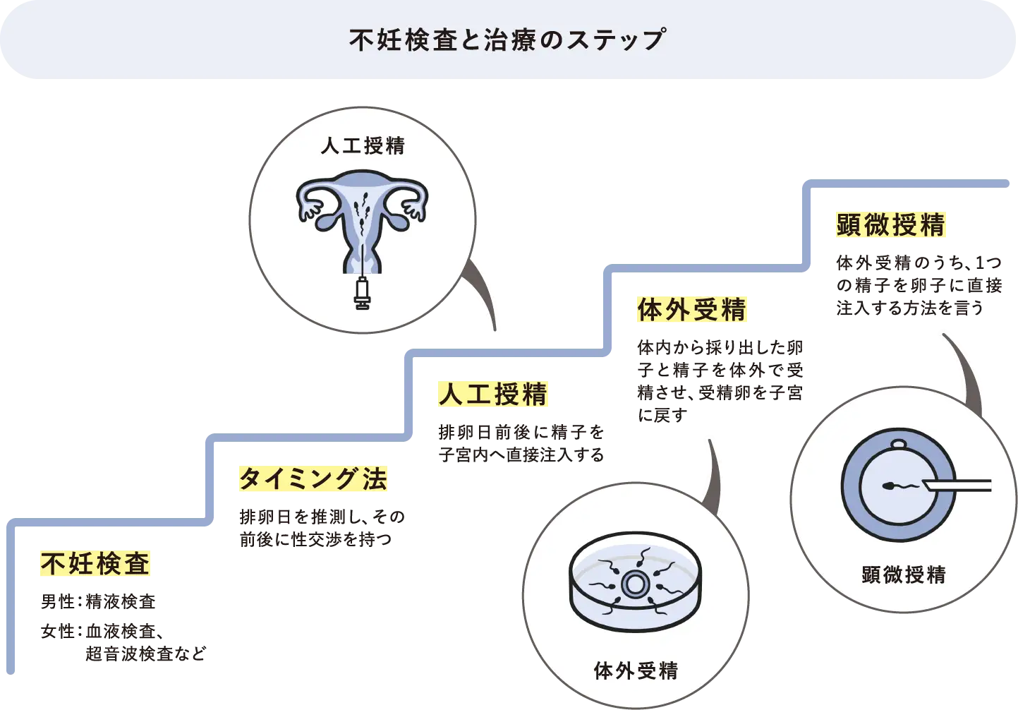 【不妊検査と治療のステップ】・不妊検査：男性：精液検査。女性：血液検査、超音波検査など / ・タイミング法：排卵日を推測し、その前後に性交渉を持つ / ・人工授精：排卵日前後に精子を子宮内へ直接注入する / ・体外受精：体内から採り出した卵子と精子を体外で受精させ、受精卵を子宮に戻す / ・顕微授精：体外受精のうち、1つの精子を卵子に直接注入する方法を言う