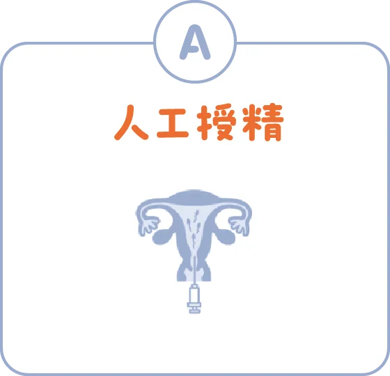 人工授精